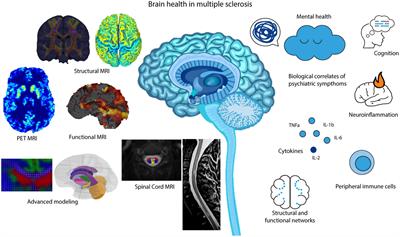 A review on multiple sclerosis prognostic findings from imaging, inflammation, and mental health studies